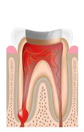 Opening made in tooth