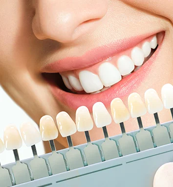 Teeth Whitening